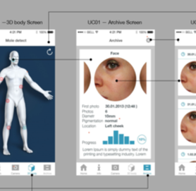 Cross-platform mobile application for skin mole detection and tracking