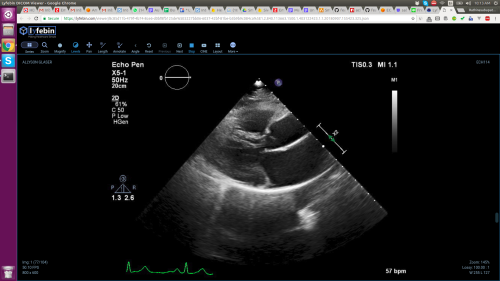 Medical Imaging Viewer