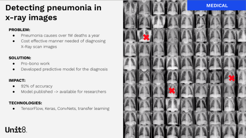 Detecting pneumonia on Xray images