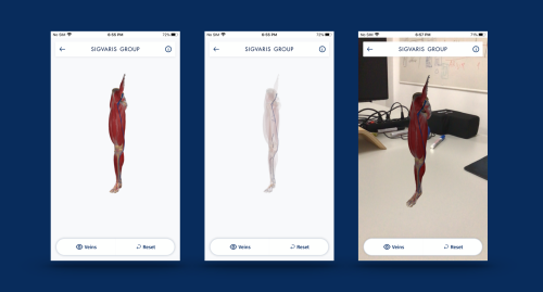 Sigvaris Augmented Reality App