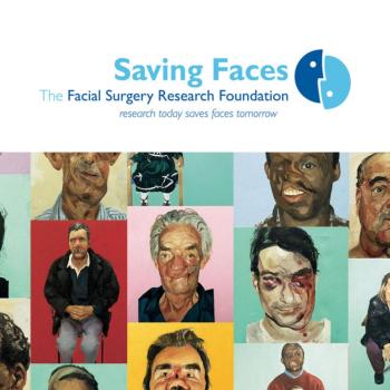 Saving Faces (Charity)
