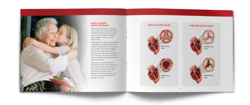 Edwards Lifesciences