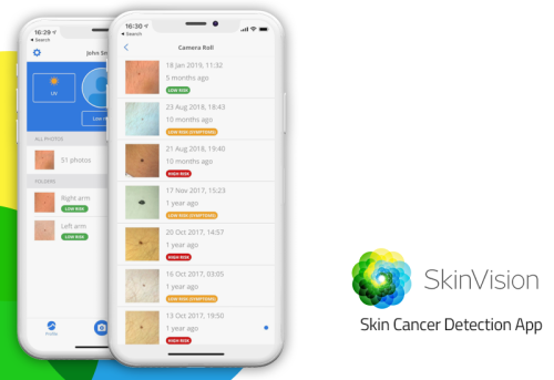 SkinVision - Skin Cancer Melanoma Detection App
