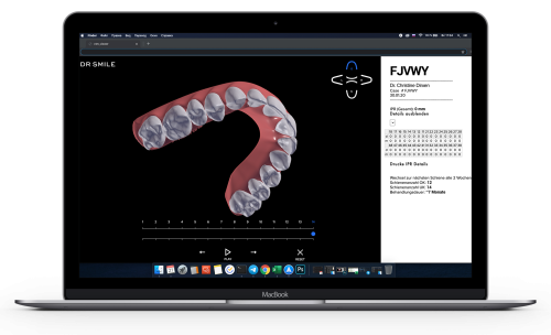 CTM 3D viewer