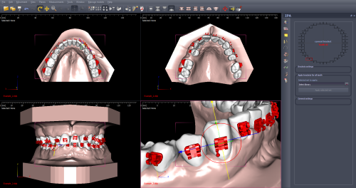 3D SOFTWARE FOR ORTHODONTISTS