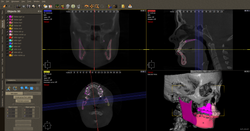 Surgery software